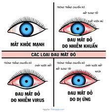 Bị đau mắt đỏ nên làm gì? 3 cách chữa đau mắt đỏ tại nhà