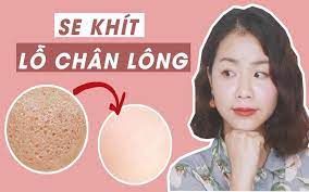 Top 6 cách se khít lỗ chân lông da mặt hiệu quả, an toàn